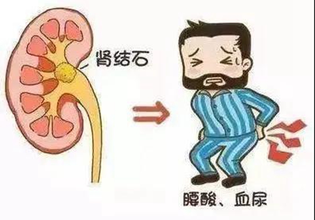 【圍觀】“植物偉哥”——秋葵，吃了真的能壯陽(yáng)？(圖6)