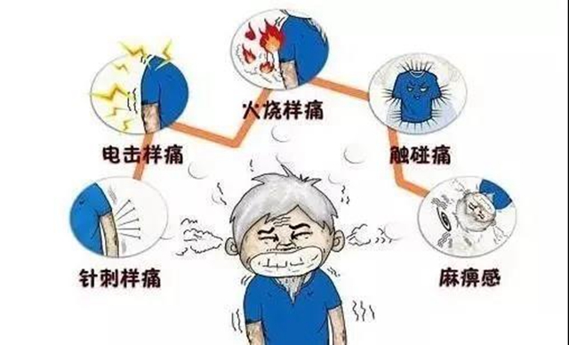 兩月“纏腰丹”fēi痛，一夕微創(chuàng)術(shù)治愈(圖3)