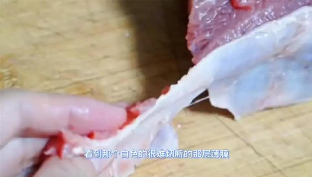 52歲大哥餓了想吐竟是腸癌 、81歲大爺70余刀挽回性命……這件事太重要！(圖9)