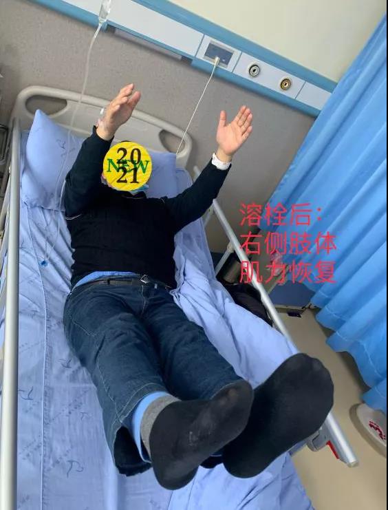 轉(zhuǎn)發(fā)可以救命！中風(fēng)急救，抓住黃金4.5小時(shí)(圖2)