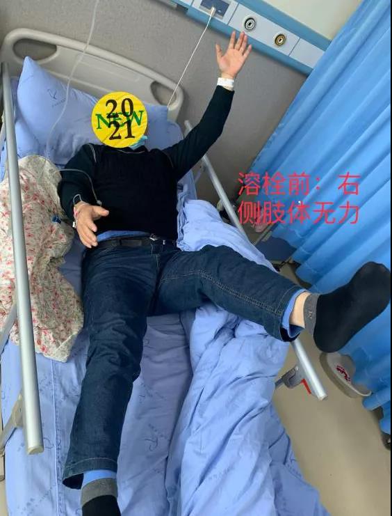 轉發(fā)可以救命！中風急救，抓住黃金4.5小時