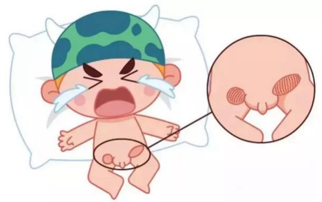 【擴散】孩子哭鬧后大腿根鼓個包？居然是……