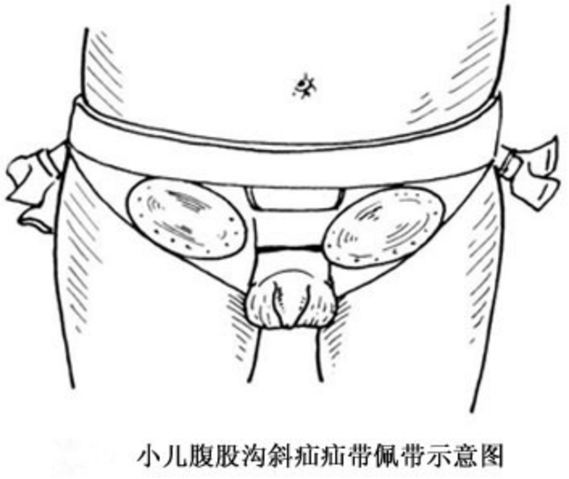 【擴(kuò)散】孩子哭鬧后大腿根鼓個(gè)包？居然是……(圖7)
