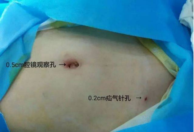 【擴(kuò)散】孩子哭鬧后大腿根鼓個(gè)包？居然是……(圖9)