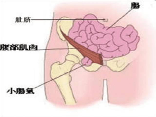 【擴(kuò)散】孩子哭鬧后大腿根鼓個(gè)包？居然是……(圖3)