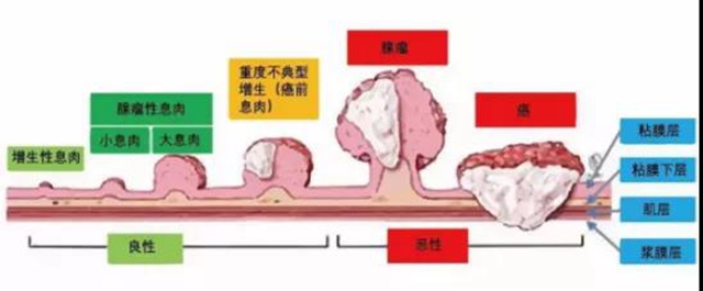 人只要活著都會得癌癥嗎？ 談癌色變不如提早預(yù)防！(圖3)