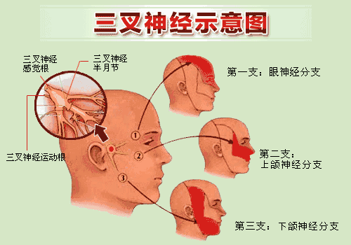 【視頻】三叉神經(jīng)痛痛痛痛痛不停，該如何拯救？趕緊戳進(jìn)來看！(圖2)