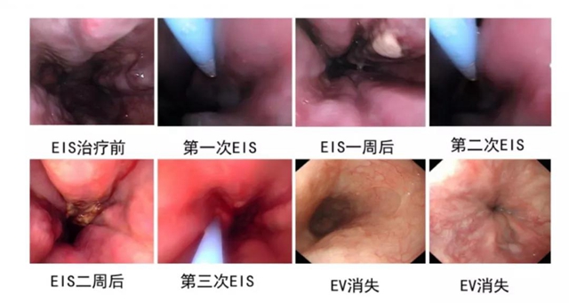 【注意】脾胃·風(fēng)濕免疫病科有新家了！(圖10)