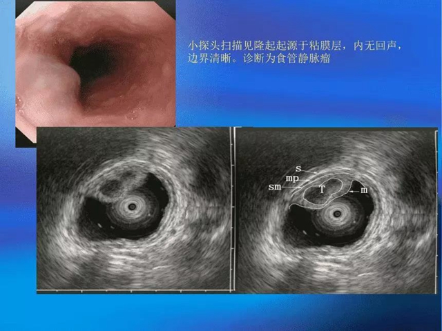 【注意】脾胃·風(fēng)濕免疫病科有新家了！(圖12)