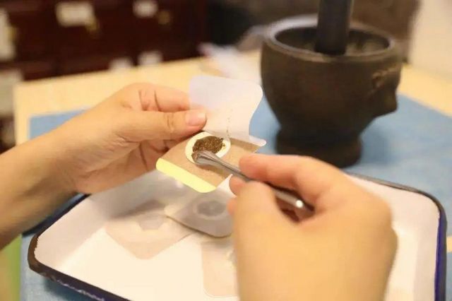 【擴散】寒潮來襲！“三九貼”貼起來……(圖5)